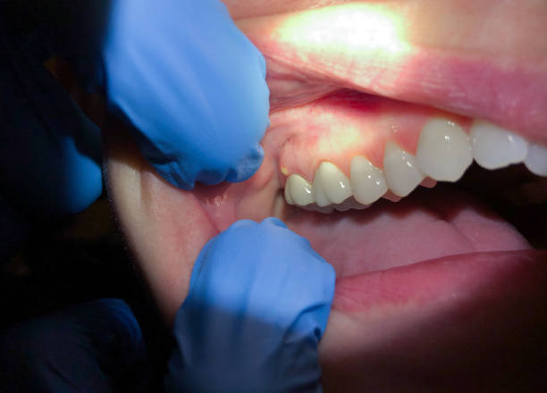 Best Weekend Emergency Dentist in Mitchellville, MD